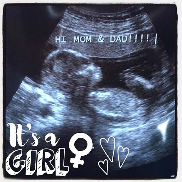 Baby Scan Photo for Gender Reveal Idea