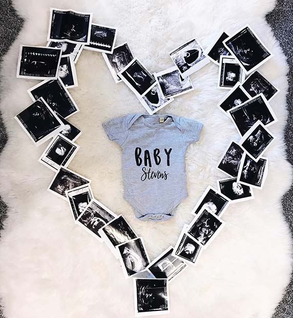 Baby Scan and Onesie Pregnancy Announcement 
